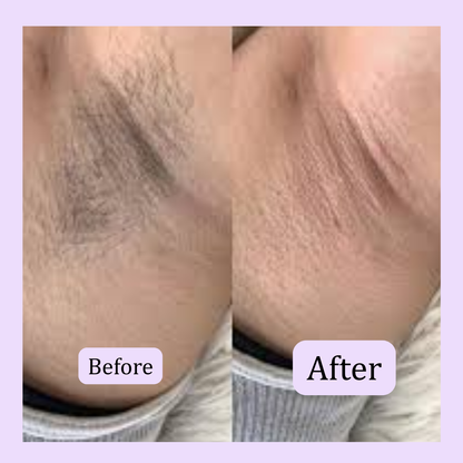 Fairy Glide™ Electric Duo Sided Shaver